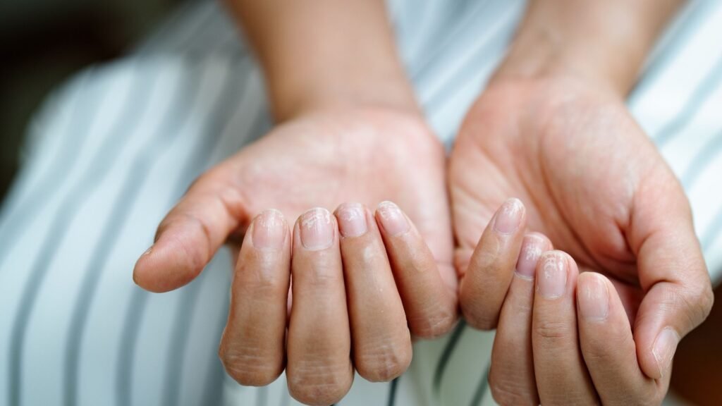 Making Your Brittle Nails Stronger